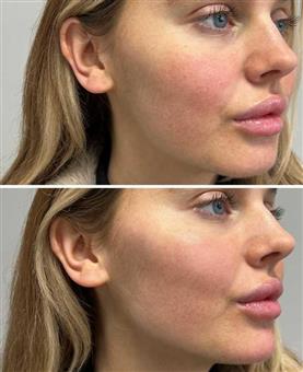 functions of glutathione The antioxidant glutathione